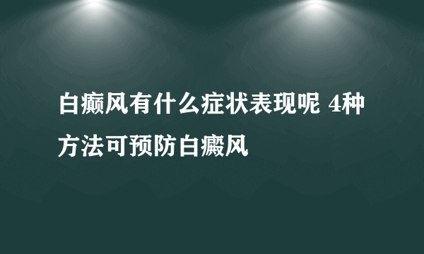 白癫风有什么症状表现呢 4种方法可预防白癜风