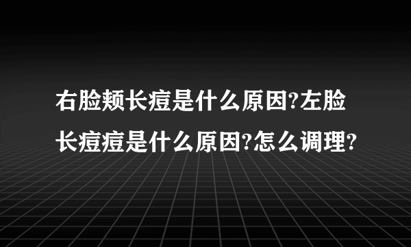 右脸颊长痘是什么原因?左脸长痘痘是什么原因?怎么调理?