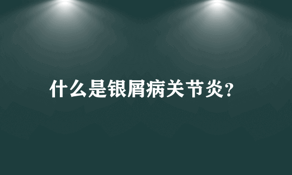 什么是银屑病关节炎？