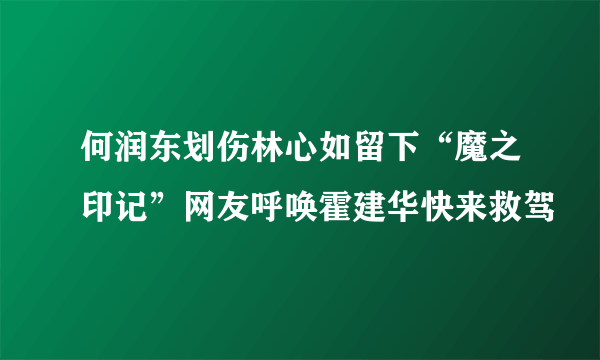 何润东划伤林心如留下“魔之印记”网友呼唤霍建华快来救驾