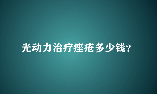 光动力治疗痤疮多少钱？