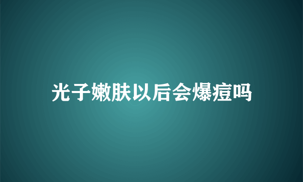 光子嫩肤以后会爆痘吗