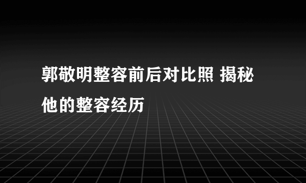 郭敬明整容前后对比照 揭秘他的整容经历