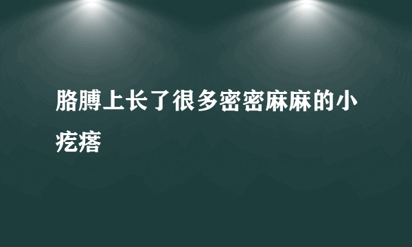 胳膊上长了很多密密麻麻的小疙瘩