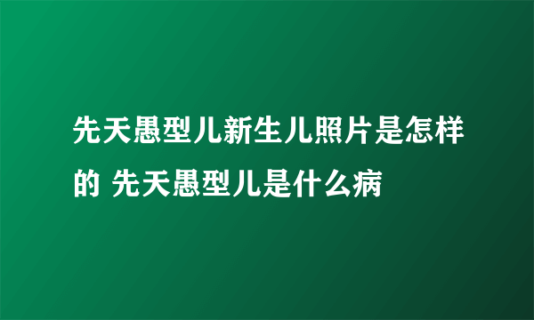 先天愚型儿新生儿照片是怎样的 先天愚型儿是什么病