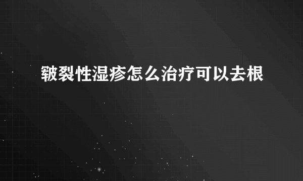 皲裂性湿疹怎么治疗可以去根