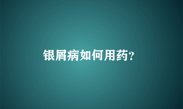 银屑病如何用药？