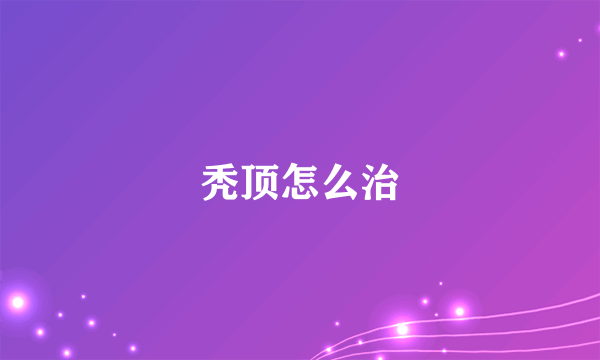 秃顶怎么治