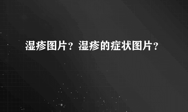 湿疹图片？湿疹的症状图片？