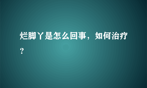 烂脚丫是怎么回事，如何治疗？