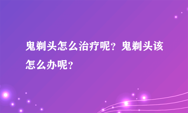 鬼剃头怎么治疗呢？鬼剃头该怎么办呢？